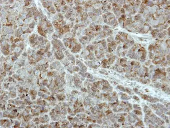 Anti-PCPTP1 antibody [C1C3] used in IHC (Paraffin sections) (IHC-P). GTX111152