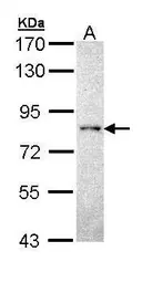 Anti-PCPTP1 antibody [C1C3] used in Western Blot (WB). GTX111152