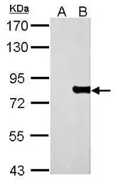 Anti-MX1 antibody used in Western Blot (WB). GTX111153