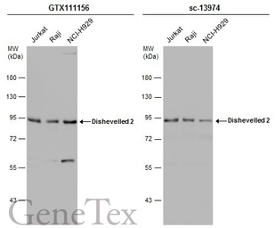 Anti-Dishevelled 2 antibody [N1N3] used in Western Blot (WB). GTX111156