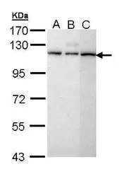 Anti-SART1 antibody [C1C3] used in Western Blot (WB). GTX111158