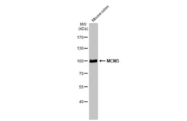 Anti-MCM3 antibody [N1N3] used in Western Blot (WB). GTX111160