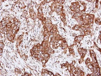 Anti-alpha Actinin 2 antibody [N2C1], Internal used in IHC (Paraffin sections) (IHC-P). GTX111167