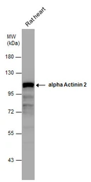 Anti-alpha Actinin 2 antibody [N2C1], Internal used in Western Blot (WB). GTX111167