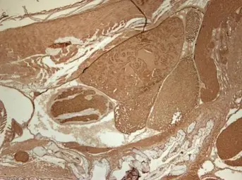 Anti-alpha Actinin 2 antibody [N2C1], Internal used in IHC (Paraffin sections) (IHC-P). GTX111167