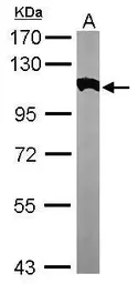 Anti-alpha Actinin 2 antibody [N2C1], Internal used in Western Blot (WB). GTX111167