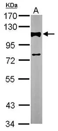 Anti-alpha Actinin 2 antibody [N2C1], Internal used in Western Blot (WB). GTX111167