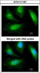 Anti-alpha Actinin 2 antibody [N2C1], Internal used in Immunocytochemistry/ Immunofluorescence (ICC/IF). GTX111167