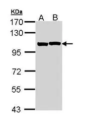 Anti-alpha Actinin 2 antibody [N2C1], Internal used in Western Blot (WB). GTX111167
