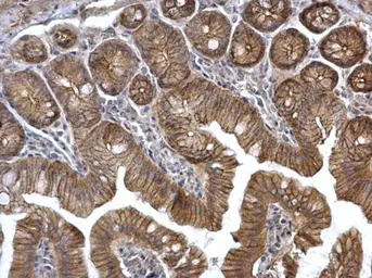 Anti-alpha Catenin antibody [N1N3] used in IHC (Paraffin sections) (IHC-P). GTX111168