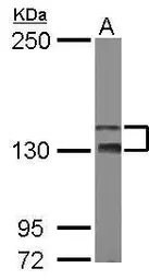 Anti-TAOK2 antibody [N1N2], N-term used in Western Blot (WB). GTX111170
