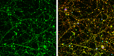 Anti-UNC13B antibody [N3C1], Internal used in Immunocytochemistry/ Immunofluorescence (ICC/IF). GTX111179