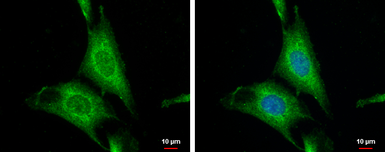 Anti-Wnt10a antibody [N1C1-2] used in Immunocytochemistry/ Immunofluorescence (ICC/IF). GTX111191
