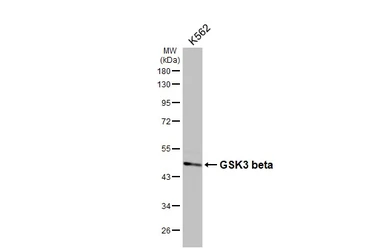 Anti-GSK3 beta antibody [C1C3] used in Western Blot (WB). GTX111192