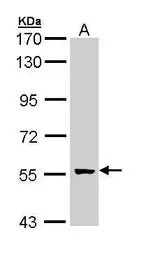 Anti-GCM2 antibody [N3C3] used in Western Blot (WB). GTX111206