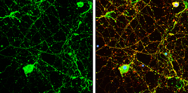 Anti-Calcineurin A antibody used in Immunocytochemistry/ Immunofluorescence (ICC/IF). GTX111207