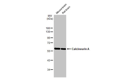 Anti-Calcineurin A antibody used in Western Blot (WB). GTX111207