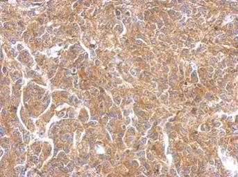 Anti-PAK1 antibody used in IHC (Paraffin sections) (IHC-P). GTX111208