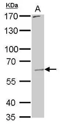 Anti-PAK1 antibody used in Western Blot (WB). GTX111208