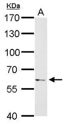 Anti-PAK1 antibody used in Western Blot (WB). GTX111208