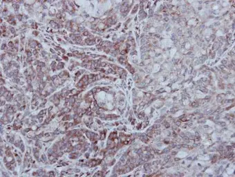 Anti-STEP / PTPN5 antibody [C1C3] used in IHC (Paraffin sections) (IHC-P). GTX111209