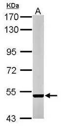 Anti-STEP / PTPN5 antibody [C1C3] used in Western Blot (WB). GTX111209