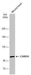 Anti-CARD10 antibody [N2C1], Internal used in Western Blot (WB). GTX111222