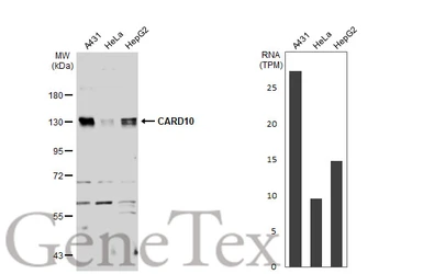 Anti-CARD10 antibody [N2C1], Internal used in Western Blot (WB). GTX111222