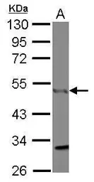 Anti-CtBP1 antibody [N2C2], Internal used in Western Blot (WB). GTX111229