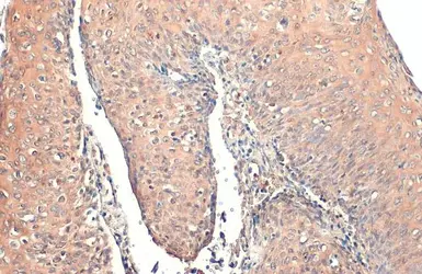 Anti-RIP antibody [C1C3] used in IHC (Paraffin sections) (IHC-P). GTX111235