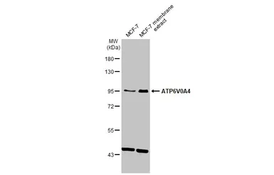 Anti-ATP6V0A4 antibody [N1N3-2] used in Western Blot (WB). GTX111243