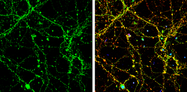Anti-UNC13B antibody [N2N3] used in Immunocytochemistry/ Immunofluorescence (ICC/IF). GTX111244
