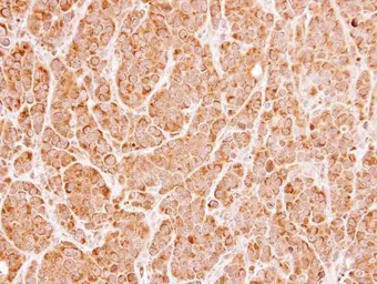 Anti-UNC13B antibody [N2N3] used in IHC (Paraffin sections) (IHC-P). GTX111244