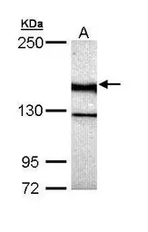 Anti-UNC13B antibody [N2N3] used in Western Blot (WB). GTX111244