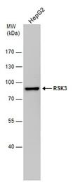 Anti-RSK3 antibody used in Western Blot (WB). GTX111247