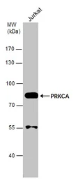 Anti-PKC alpha antibody used in Western Blot (WB). GTX111252
