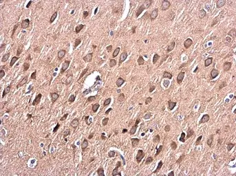 Anti-PKC alpha antibody used in IHC (Paraffin sections) (IHC-P). GTX111252