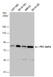 Anti-PKC alpha antibody used in Western Blot (WB). GTX111252