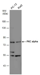 Anti-PKC alpha antibody used in Western Blot (WB). GTX111252