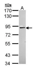 Anti-PKC alpha antibody used in Western Blot (WB). GTX111252