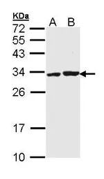 Anti-APIP antibody [N1C3] used in Western Blot (WB). GTX111264