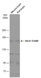 Anti-Her4 / ErbB4 antibody [C1C3] used in Western Blot (WB). GTX111276