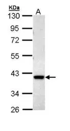 Anti-DUSP6 antibody [N2C3] used in Western Blot (WB). GTX111292