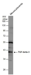 Anti-TGF beta 3 antibody [N1C1] used in Western Blot (WB). GTX111296