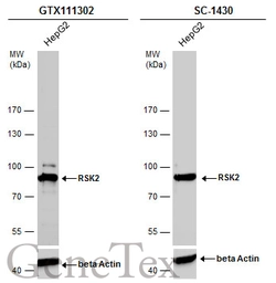 Anti-RSK2 antibody used in Western Blot (WB). GTX111302