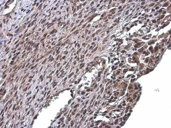 Anti-RSK2 antibody used in IHC (Paraffin sections) (IHC-P). GTX111302