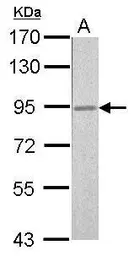 Anti-RSK2 antibody used in Western Blot (WB). GTX111302