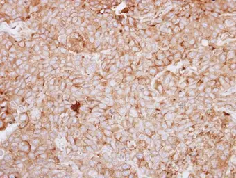 Anti-DDR1 antibody [C1C3] used in IHC (Paraffin sections) (IHC-P). GTX111312