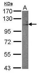 Anti-DDR1 antibody [C1C3] used in Western Blot (WB). GTX111312