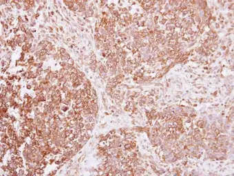 Anti-Insulin Receptor beta antibody used in IHC (Paraffin sections) (IHC-P). GTX111314